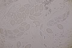 Pseudomassaria chondrospora