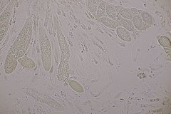 Pseudomassaria chondrospora