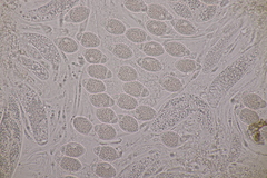 Pseudomassaria chondrospora