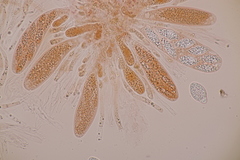 Pseudomassaria chondrospora