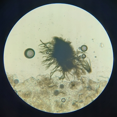 Bartheletia paradoxa