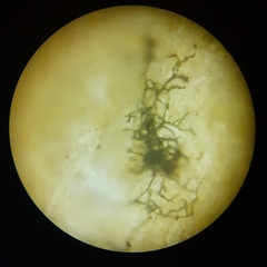 Bartheletia paradoxa