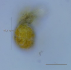 Anthoceros agrestis