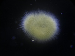 Gloeotrichia echinulata