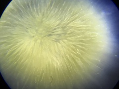 Gloeotrichia echinulata