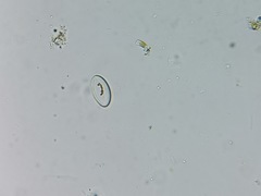 Cocconeis placentula