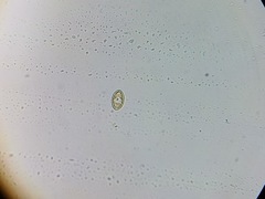 Cocconeis placentula