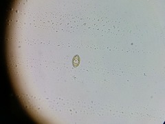 Cocconeis placentula