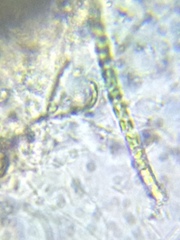 Ulothrix