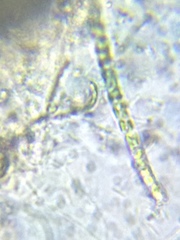 Ulothrix