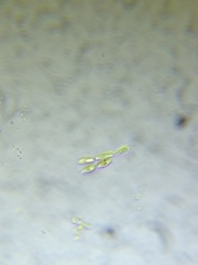 Dinobryon sertularia