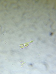 Dinobryon sertularia
