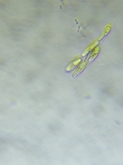 Dinobryon sertularia