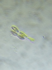 Dinobryon sertularia