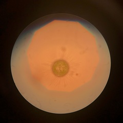 Golenkinia