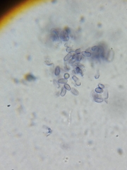 Artomyces cristatus