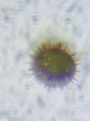 Trachelomonas hispida