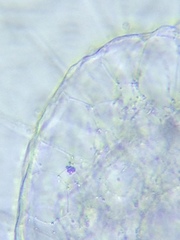 Actinosphaerium