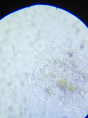 Actinosphaerium