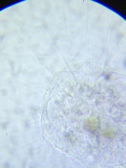 Actinosphaerium