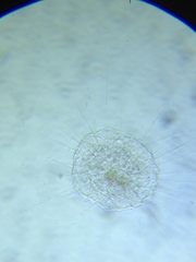 Actinosphaerium