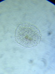 Actinosphaerium