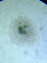 Actinosphaerium