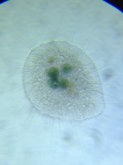 Actinosphaerium