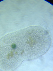 Actinosphaerium