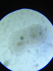 Actinosphaerium