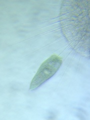 Stentor multiformis