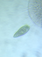 Stentor multiformis