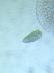 Stentor multiformis