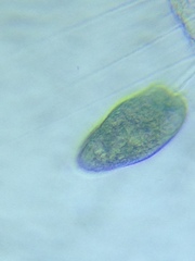 Stentor multiformis