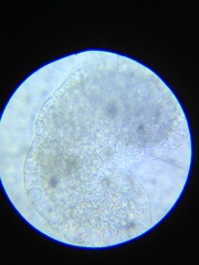 Actinosphaerium