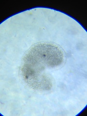 Actinosphaerium