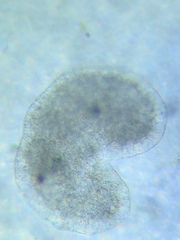 Actinosphaerium