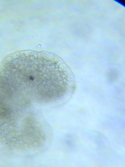 Actinosphaerium