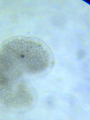 Actinosphaerium