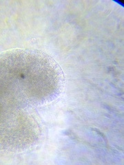Actinosphaerium