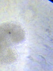 Actinosphaerium