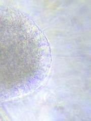 Actinosphaerium