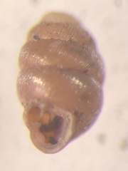 Vertigo angustior