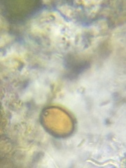 Trachelomonas euchlora