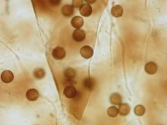 Lamproderma maculatum