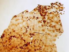 Lamproderma maculatum