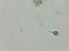 Distigma