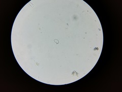 Cocconeis placentula