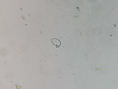 Cocconeis placentula