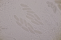 Pseudomassaria chondrospora